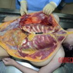 Raped girl in morgue