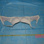 Raped girl in morgue