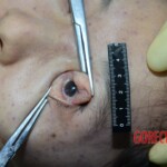 Raped girl in morgue