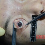 Raped girl in morgue