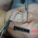 Raped girl in morgue