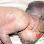 Junkie's giving a birth