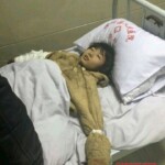 Dead Chinese girl