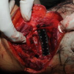 Machete attack victim