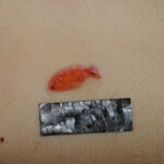 Machete attack victim