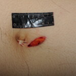 Machete attack victim