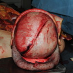 Machete attack victim