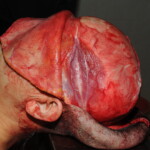 Machete attack victim