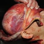 Machete attack victim