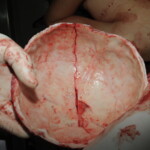 Machete attack victim