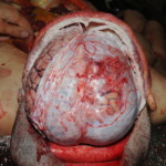 Machete attack victim