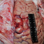 Machete attack victim