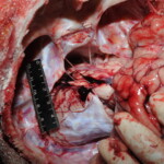 Machete attack victim