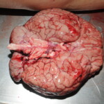 Machete attack victim