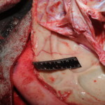 Machete attack victim