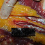 Machete attack victim