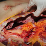 Machete attack victim