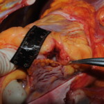 Machete attack victim