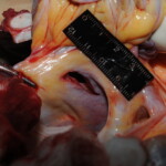 Machete attack victim