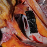 Machete attack victim