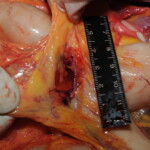 Machete attack victim