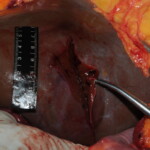 Machete attack victim