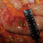 Machete attack victim