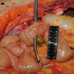 Machete attack victim