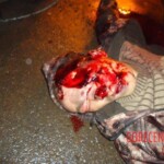 Tyre explosion death