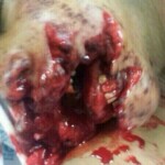 Plastic surgery of jaw after failed suicide attempt