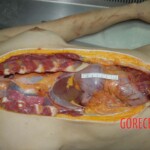 Raped and hanged Chinese woman