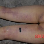 Raped and murdered prostitute