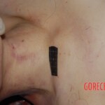 Raped and murdered prostitute