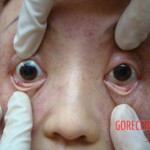 Raped and stabbed girl