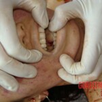 Raped and stabbed girl