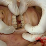 Raped and stabbed girl