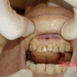 Raped and stabbed girl