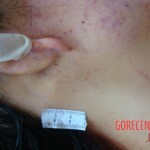 Raped and stabbed girl