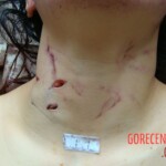 Raped and stabbed girl