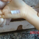 Raped and stabbed girl