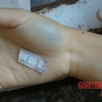 Raped and stabbed girl