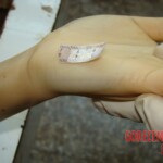 Raped and stabbed girl