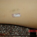 Raped and stabbed girl