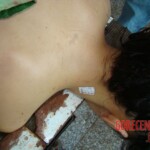 Raped and stabbed girl