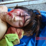 Raped and stabbed girl