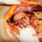 Raped and stabbed girl