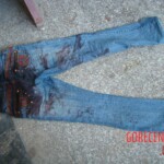 Raped and stabbed girl