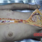 Raped young Chinese woman in morgue