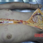 Raped young Chinese woman in morgue