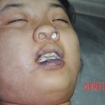 Raped young Chinese woman in morgue